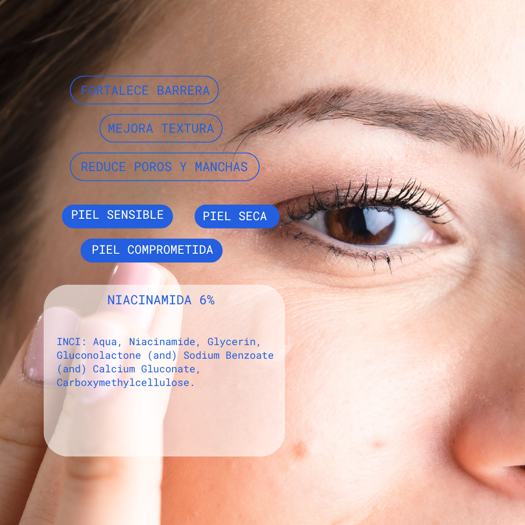 KIT BEAUTYCASTER® TRATAMIENTO CHAU ACNE PARA PIEL SENSIBLE