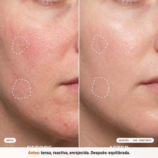 Prep & Calm Serum Milaborit - La Beautyneta