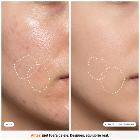 Ultrabalance5+ Serum Milaborit - La Beautyneta