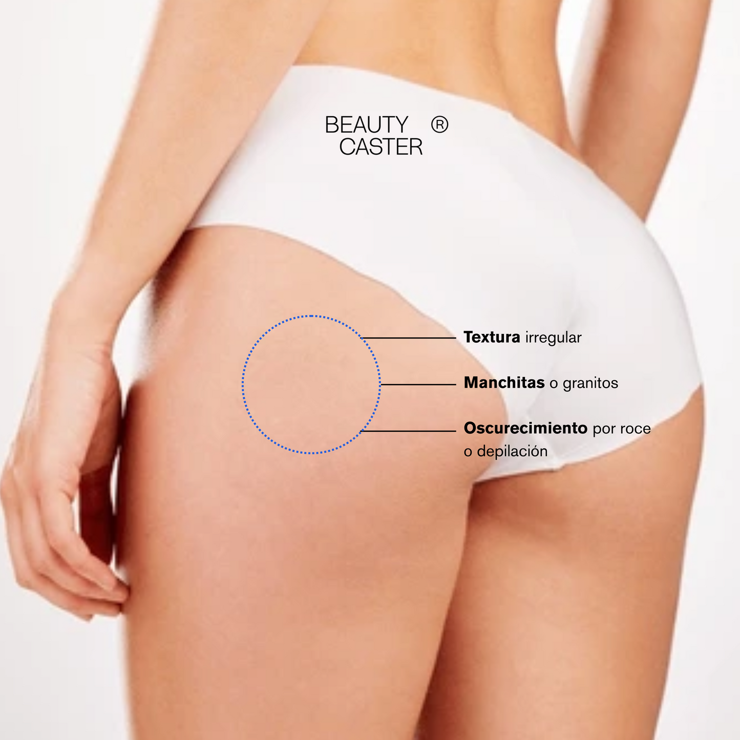 KIT BEAUTYCASTER® TRATAMIENTO CLARIDAD SUAVE – ZONAS SENSIBLES MÁS UNIFORMES
