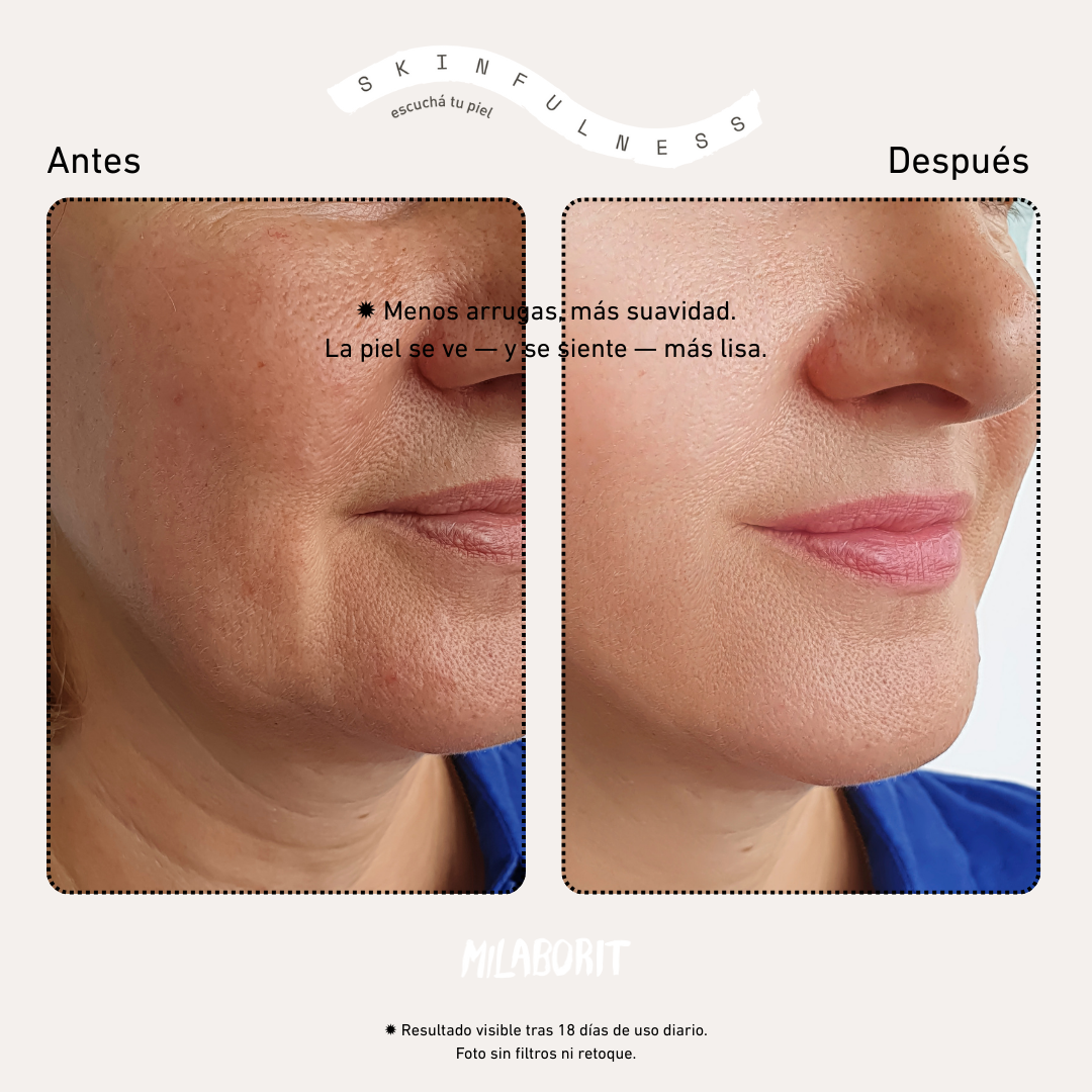 Kit Firmeza + Protección Diaria (Botox-Like Día) Milaborit