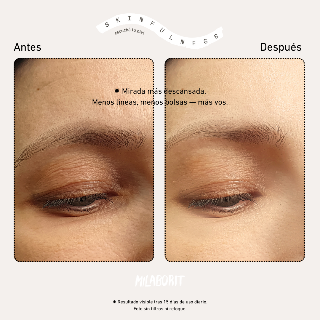 EyeUp All-in-1+ Milaborit