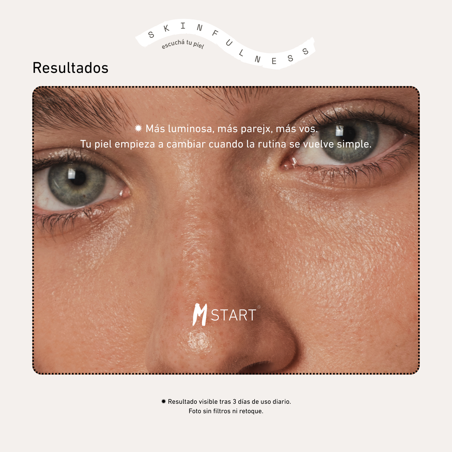 Kit Manchas + Tono Parejo · Glow-Like Milaborit