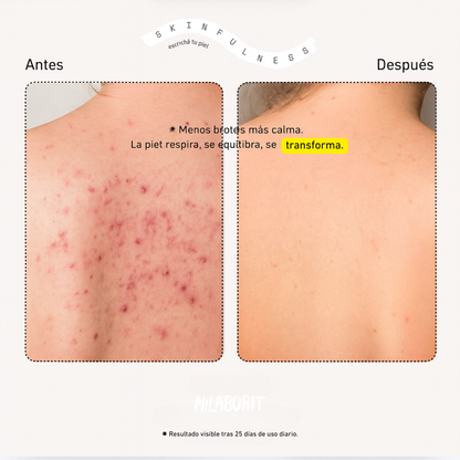 Ultrabalance5+ Serum Milaborit