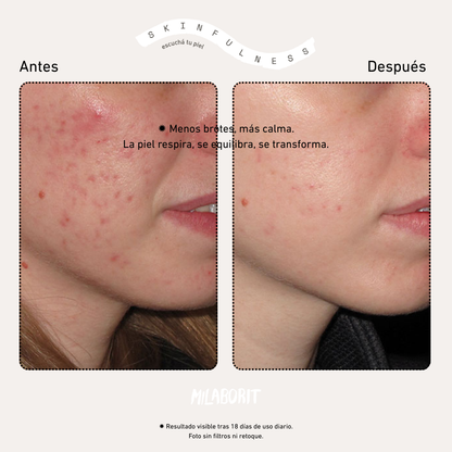 Ultrabalance5+ Serum Milaborit