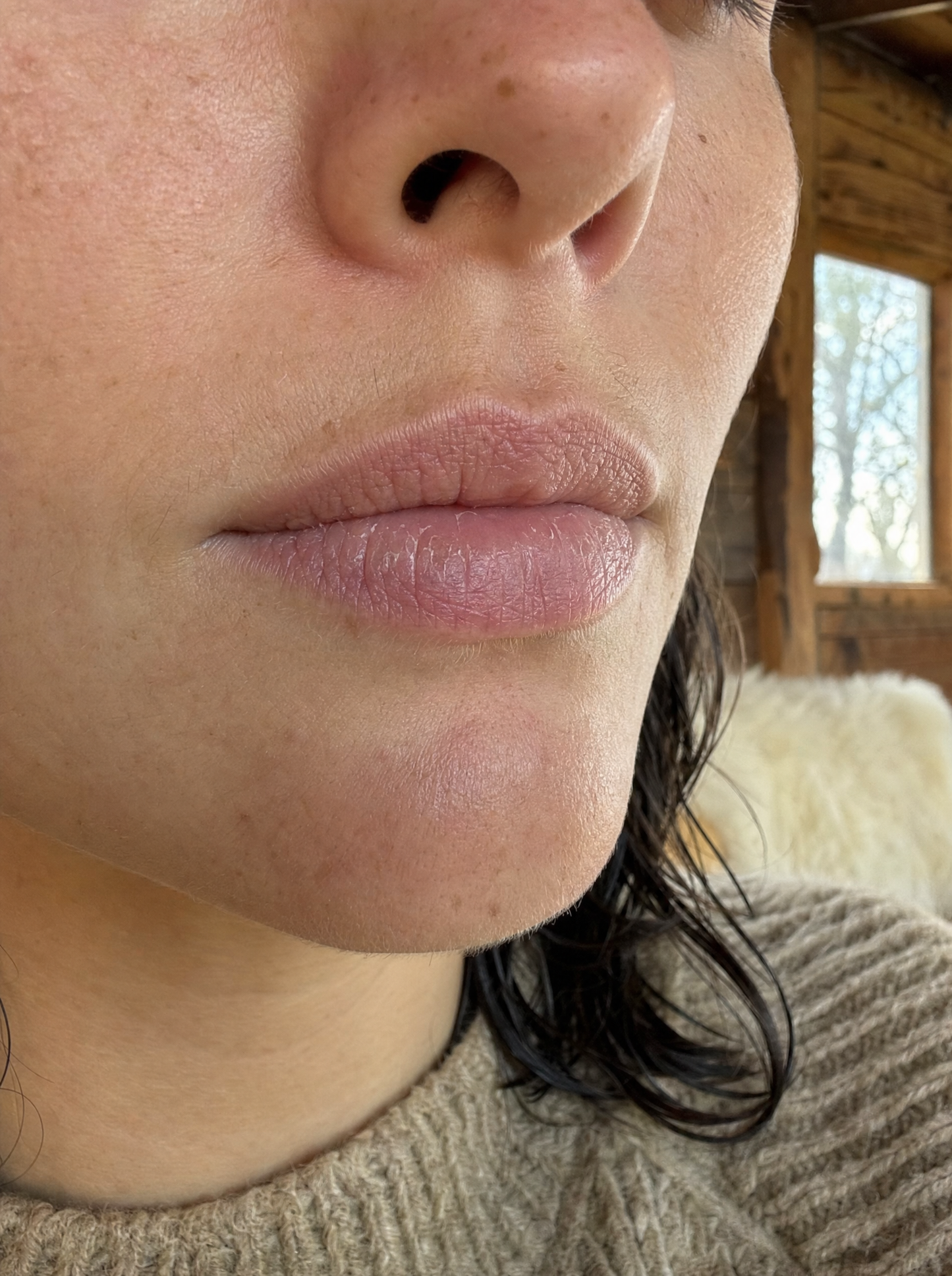 Patagonia Rescue Balm - Bálsamo Multiuso con Caléndula VegaPlay