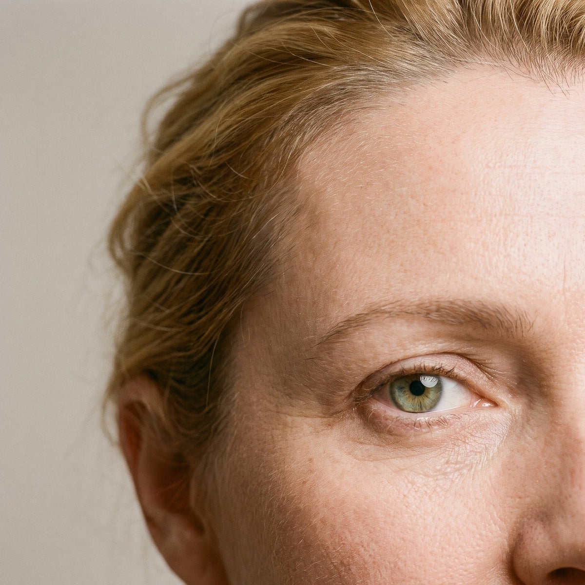 Problema: líneas finas en el contorno de ojos