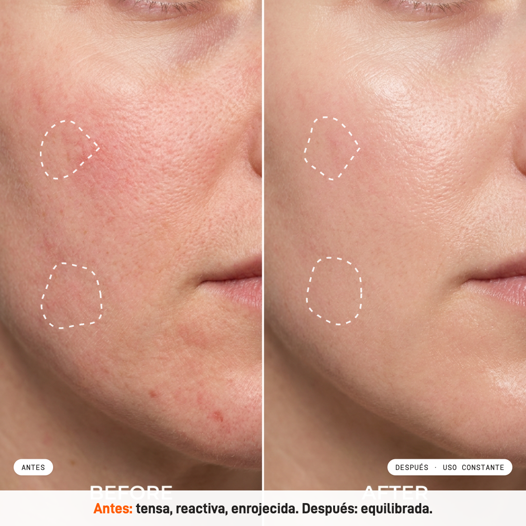 Prep & Calm Serum Milaborit - La Beautyneta