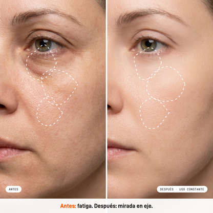 EyeUp All-in-1+ Milaborit - La Beautyneta
